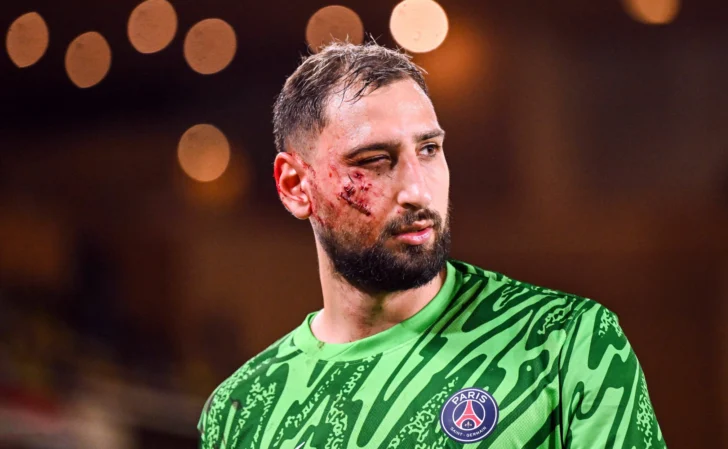 Le destrozó la cara a Donnarumma y no fue expulsado: “Perdón”